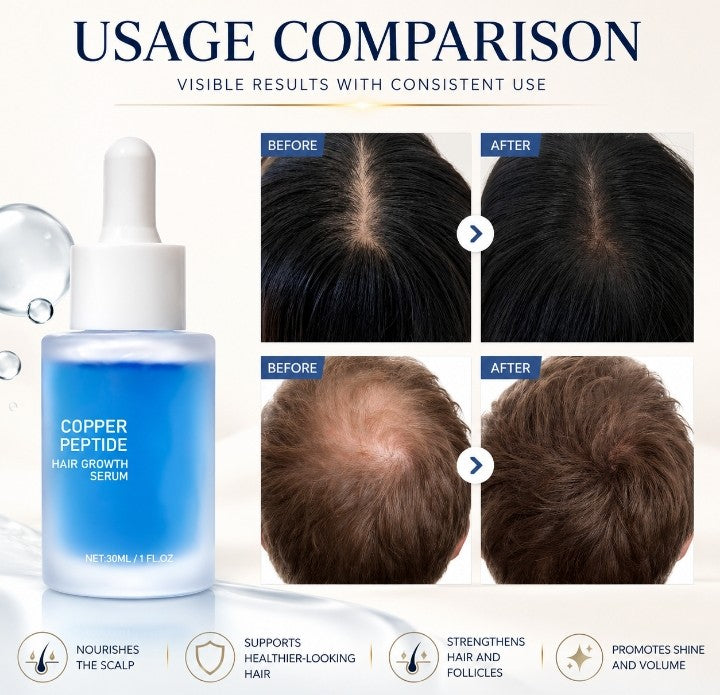 Dynova™ Hair Growth Serum with Blue Copper Peptide